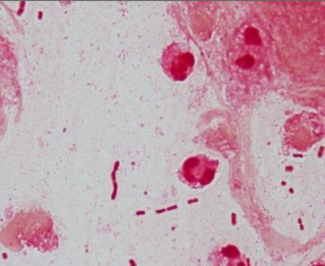 Bacteriology USMLE Step 1 question figure
